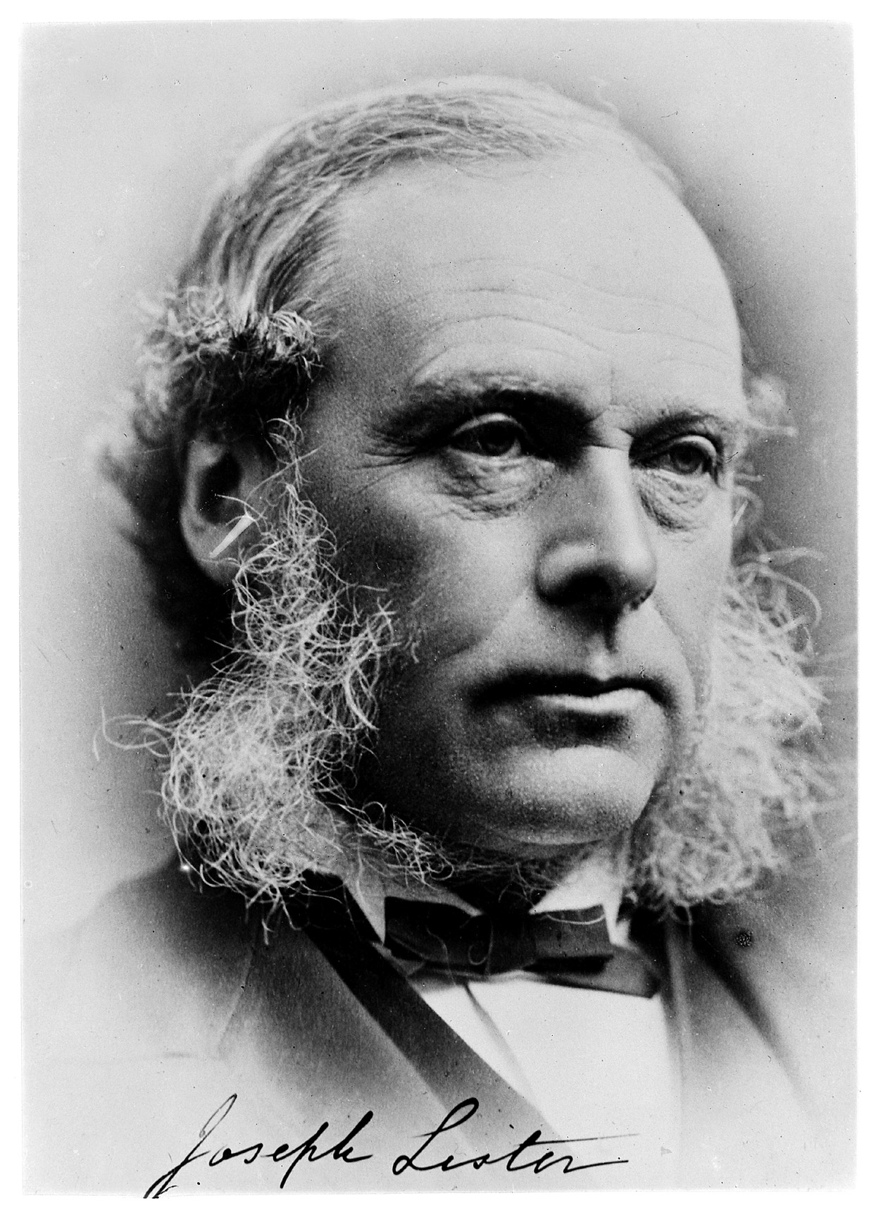 Joseph Lister foto
